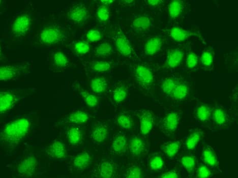Polyclonal Rabbit anti-Human Aprataxin / APTX Antibody (IHC, IF, WB)