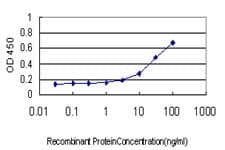 PSMB6 Antibody (clone S51)