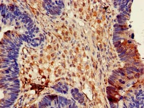 Polyclonal Rabbit anti-Human DPYSL4 / CRMP3 Antibody (IHC, IF)