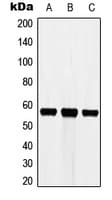 CYP3A7 Antibody (Internal)