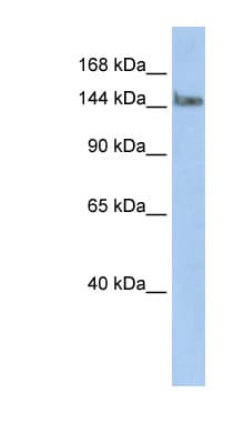 Polyclonal Rabbit anti-Human TCERG1 / CA150 Antibody (N-Terminus, WB)