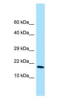 Polyclonal Rabbit anti-Human CFC1 Antibody (N-Terminus, WB)
