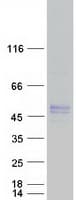 Human PDHA1 / PDH E1 Alpha Protein (Recombinant Myc-DDK (Flag))