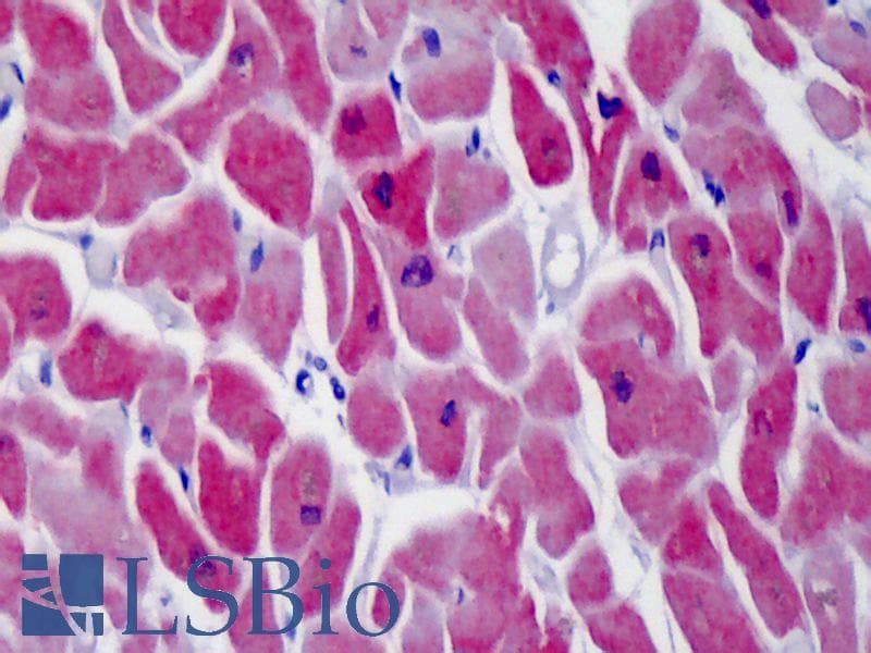 IHC-plus™ ATP2A1 / SERCA1 Antibody (clone 4B8)