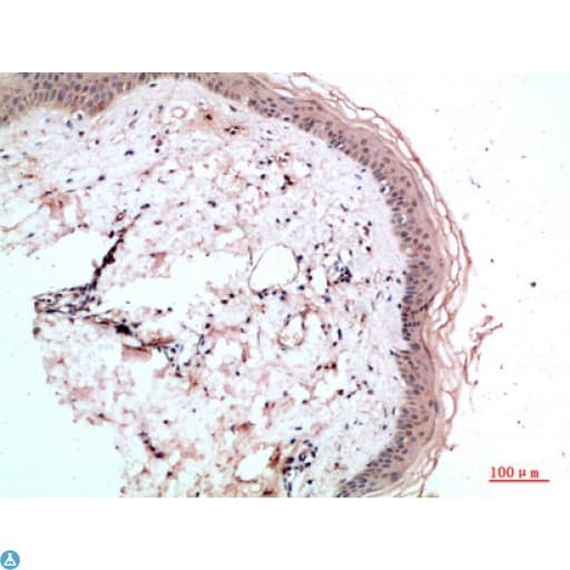 RCC1 Antibody