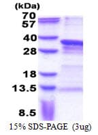 Human PRX-1 / PRRX1 Protein (Recombinant His)