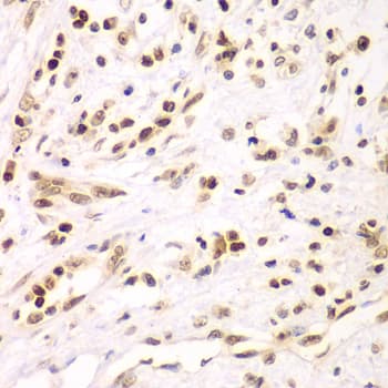 Polyclonal Rabbit anti-Human IKBKB / IKK2 / IKK Beta Antibody (IHC, IF, WB)
