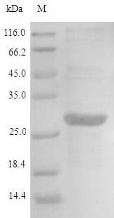 Human AIMP2 Protein (Recombinant 6His, N-terminus)
