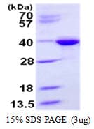 Human STX3 / Syntaxin 3 Protein (Recombinant His)