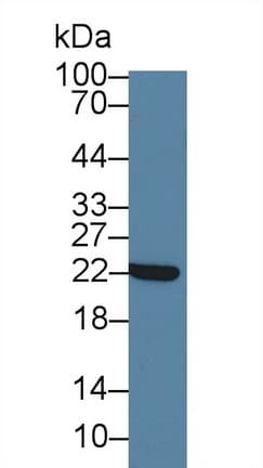 CRYAB / Alpha B Crystallin Antibody (aa1-175, Biotin)
