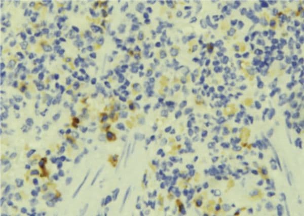 Polyclonal Rabbit anti-Human FAM65B / DIFF48 Antibody (IHC, WB)