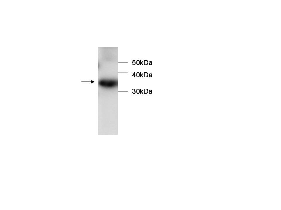 PRDX6 / Peroxiredoxin 6 Antibody