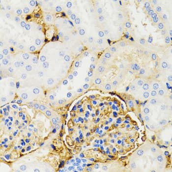 GALT Antibody