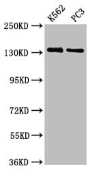 Polyclonal Rabbit anti-Human NRD1 / Nardilysin Antibody (IF, WB)