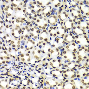 Polyclonal Rabbit anti-Human Histone H3 Antibody (Di-Methyl-Lys4, IHC, IF, WB)