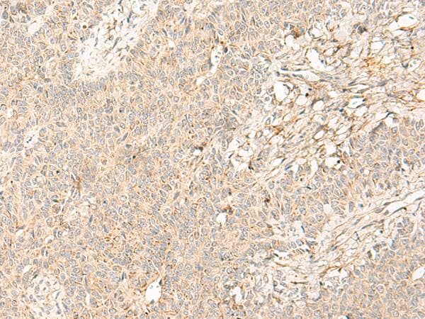 GPR44 / CRTH2 Antibody