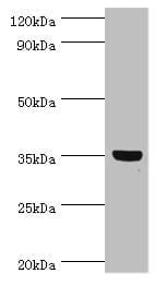 GLYATL1 Antibody (aa1-302)