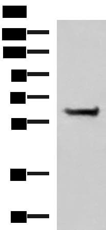 PPP2R1A Antibody