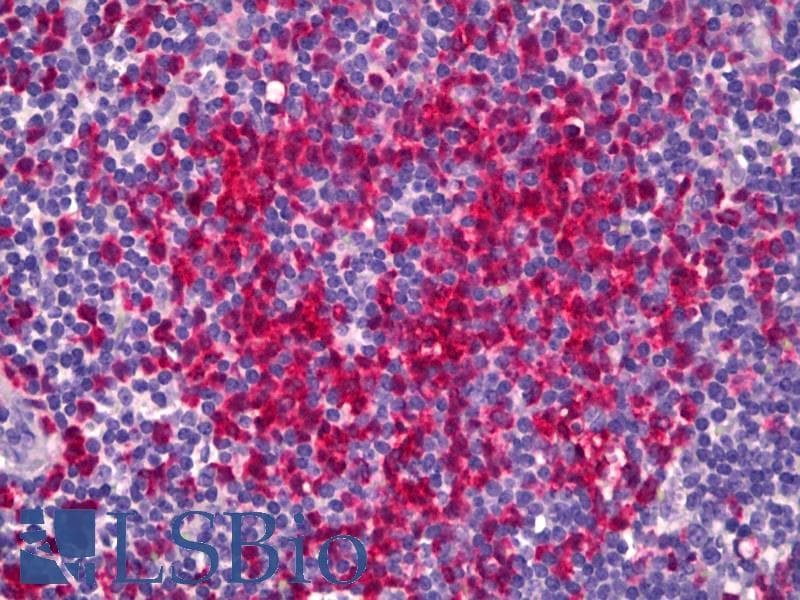 PathPlus™ S100A9 / MRP14 Antibody (clone 47-8D3, Concentrated)
