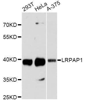 LRPAP1 Antibody