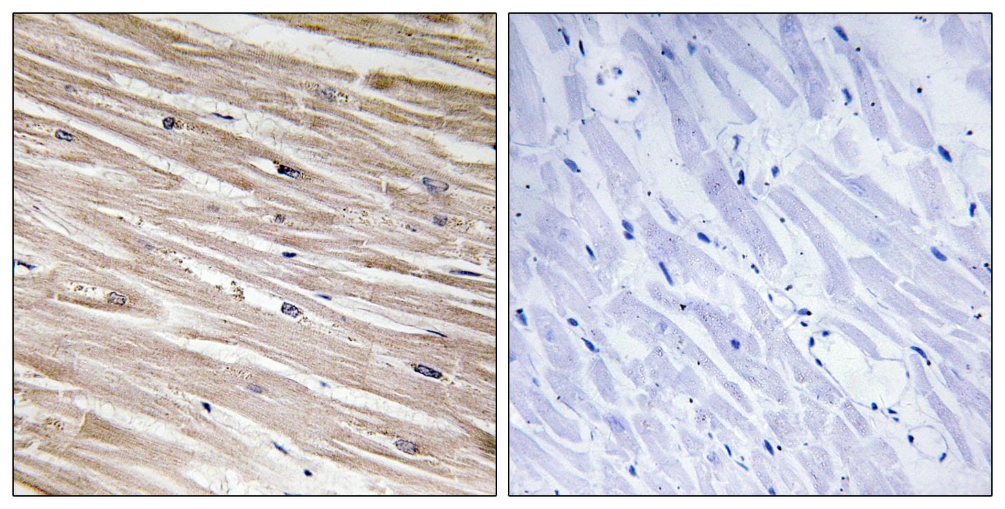 Polyclonal Rabbit anti-Human PEA15 / PEA-15 Antibody (phospho-Ser104, IHC, WB)