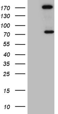 ARHGAP5 / RhoGAP5 Antibody (aa948-1261, clone OTI9H2)
