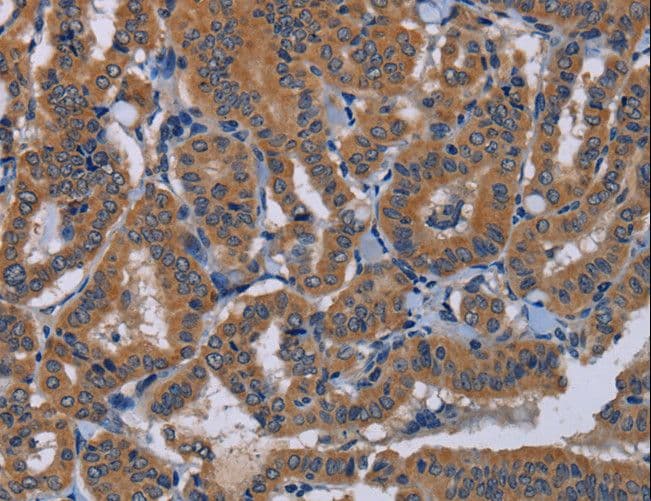 NPTX1 Antibody