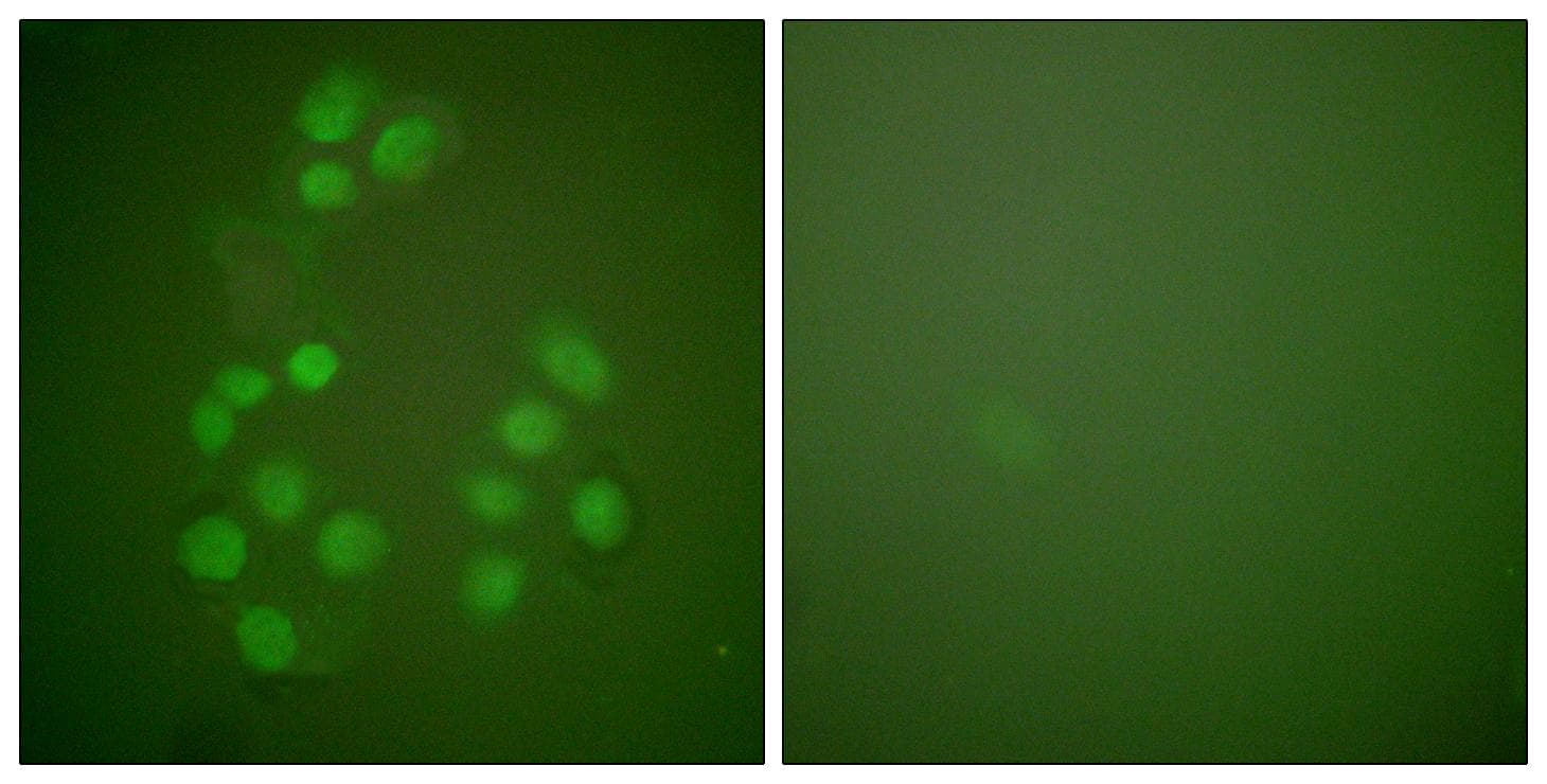 CREBBP / CREB Binding Protein Antibody
