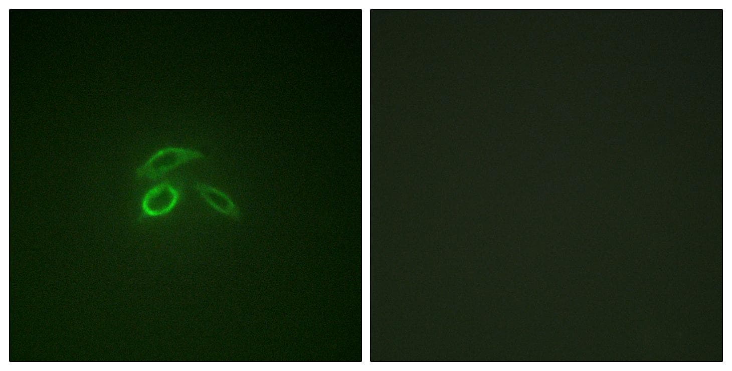 Polyclonal Rabbit anti-Human EMA / MUC1 Antibody (phospho-Tyr1229, IHC, IF, WB)