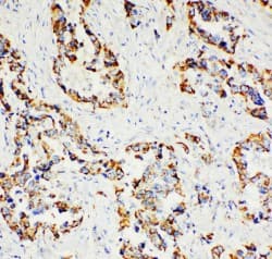 Polyclonal Rabbit anti-Human PXN / Paxillin Antibody (aa456-472, IHC, WB)