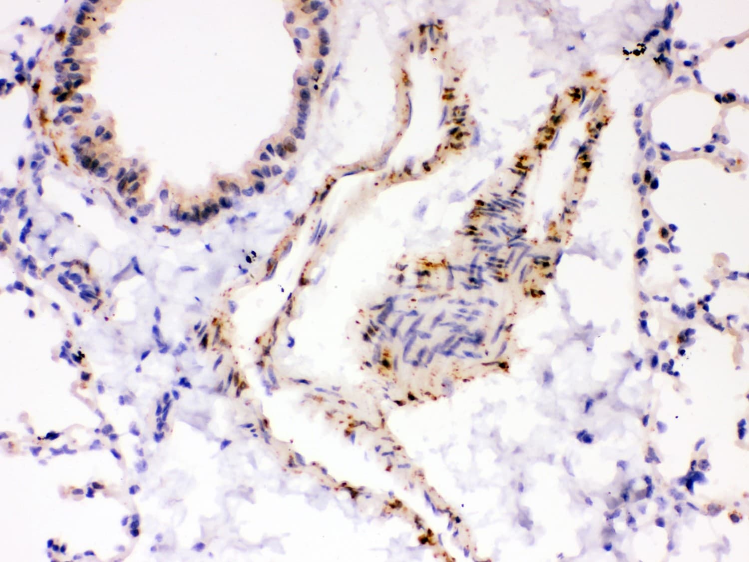 ATP2A2 / SERCA2 Antibody (aa1-32)