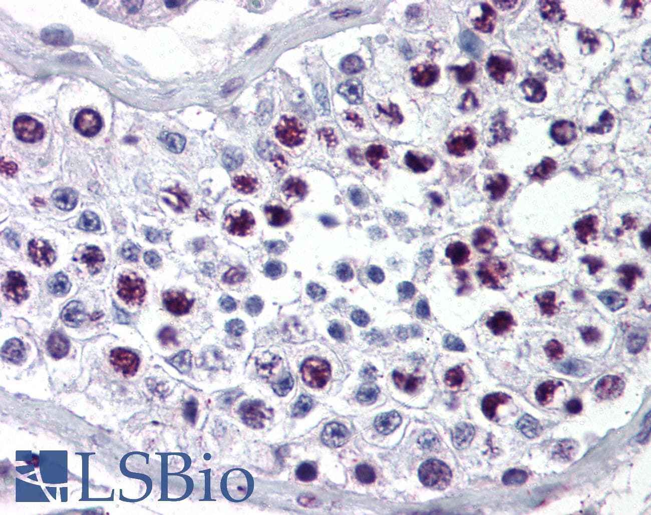 IHC-plus™ Polyclonal Rabbit anti-Human Cyclin A Antibody (IHC, WB)