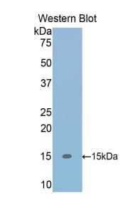 TGFB1 / TGF Beta 1 Antibody (aa279-390)