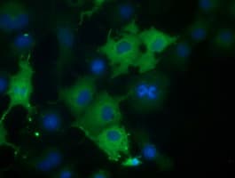 IHC-plus™ CORO1B Antibody (clone 3D10)