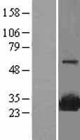 Human SRI / Sorcin Protein (Over-Expression Lysate Myc-DDK (Flag))
