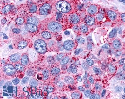PathPlus™ FAK / Focal Adhesion Kinase Antibody (C-Terminus)