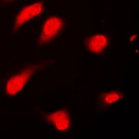 Polyclonal Rabbit anti-Human Securin / PTTG1 Antibody (Internal, IHC, IF, WB)