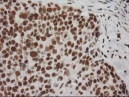 LOX / Lysyl Oxidase Antibody (clone OTI9G2)