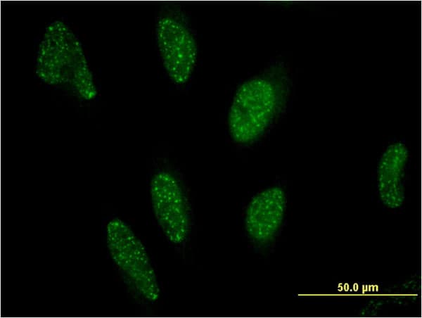 PPARA / PPAR Alpha Antibody (clone 1A8)
