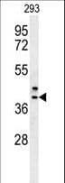 CAMLG / CAML Antibody (aa111-138)