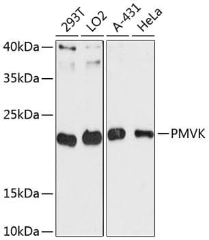 Polyclonal Rabbit anti-Human PMVK Antibody (WB)
