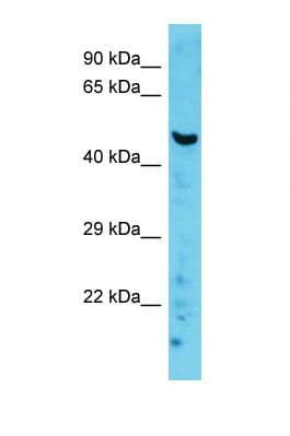 Polyclonal Rabbit anti-Mouse PRKCQ / PKC-Theta Antibody (C-Terminus, WB)