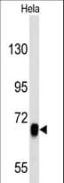 EGFR Antibody