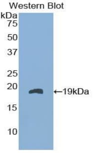 FABP9 / Lipid-Binding Protein Antibody (aa1-132)
