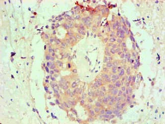 BCL2L1 / BCL-XL Antibody (aa1-209, clone 2C11C2)