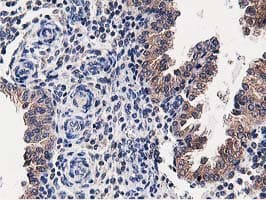 OSBP Antibody (clone OTI1F2)