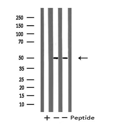 LHX1 Antibody