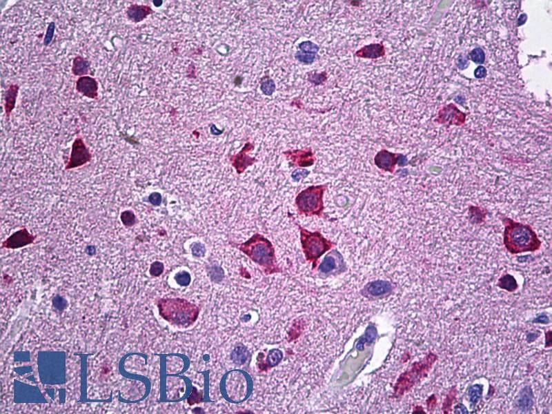 IHC-plus™ NRGN / Neurogranin Antibody (aa45-55)