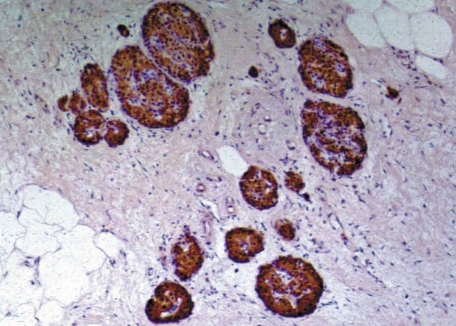 Insulin C-Peptide Antibody (clone C-PEP-01, Biotin)
