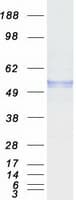 Human RCBTB2 Protein (Recombinant Myc-DDK (Flag))